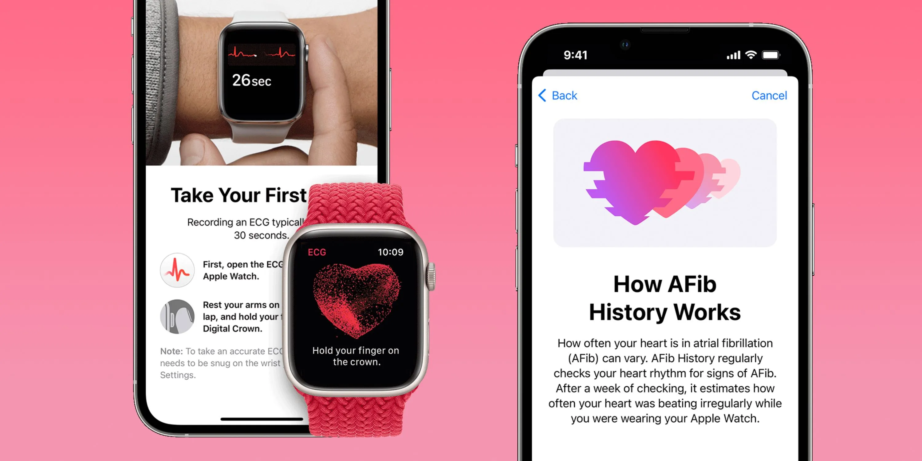 apple watch ECG and AFib History